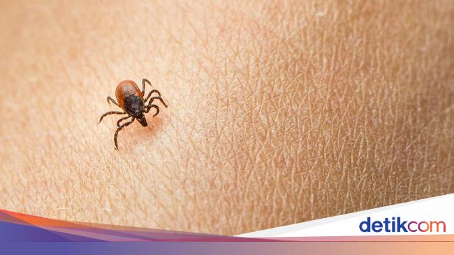 Memakan Korban di Jepang, Kenali Virus Oz yang Mematikan